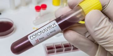 Κορονοϊός: Ο Rt δεν ανεβαίνει, τα κρούσματα καλπάζουν